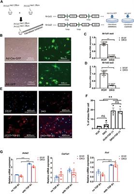 REV-ERB is essential in cardiac fibroblasts homeostasis